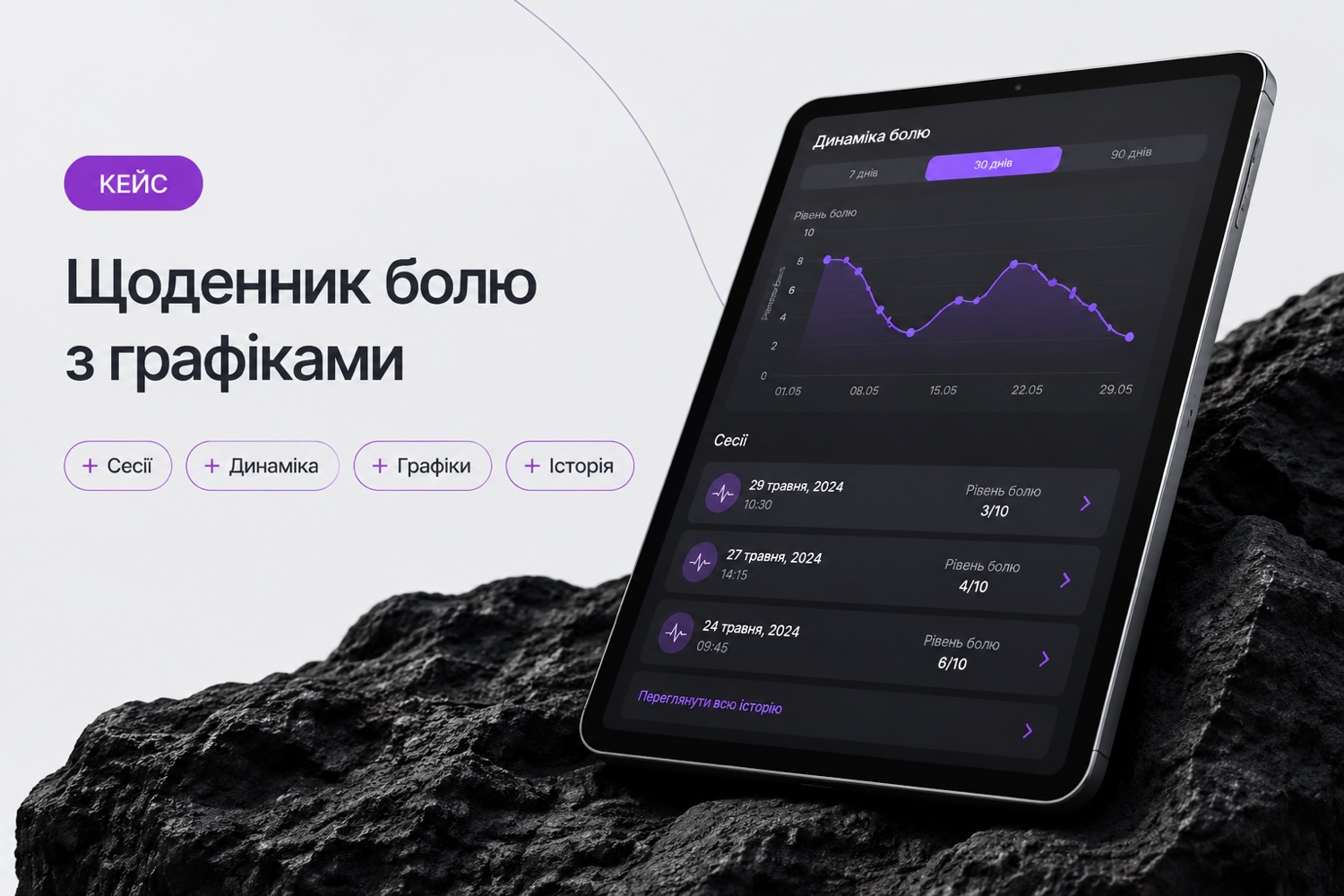Щоденник фантомного болю з графіками